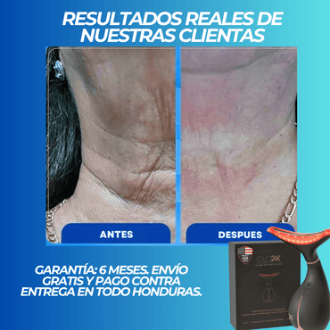 GlowLift Pro™ – Dispositivo Facial LED 3 en 1 con Tecnología GoldRadiance™ - ClickStore Honduras