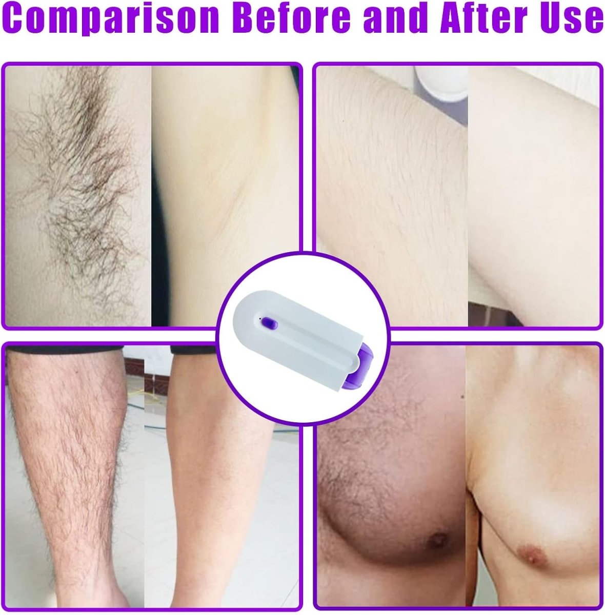 SilkLight™ – Depiladora Recargable con Luz LED para Rostro y Cuerpo 12 meses garantia - ClickStore Honduras