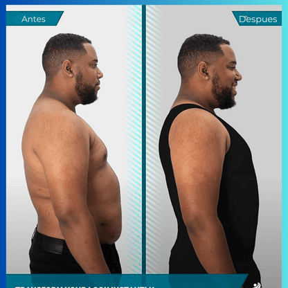 SlimForm Pro™ – Faja de Compresión y Moldeado Masculino de Alta Tecnología - ClickStore Honduras